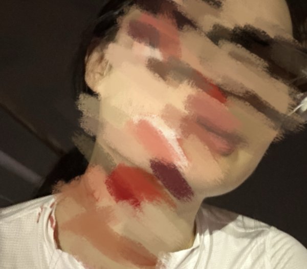 东信证券 女子在成都绿道骑行被鱼线绊倒 面部身上多处受伤